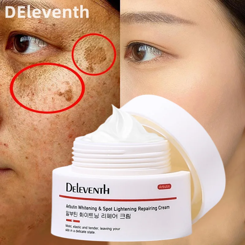 Korea Freckle Cream Chloasma Black Spot Remove Whitening Brighten Skin