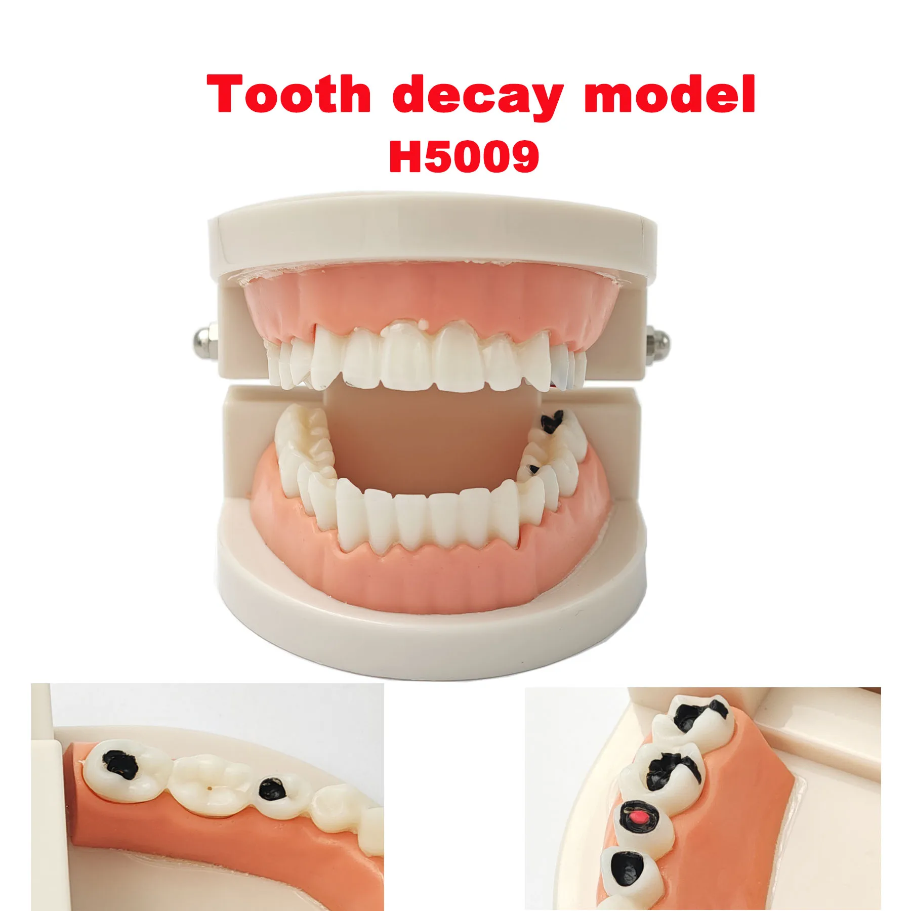 

Dental Model Teeth With Caries Dentist Teaching Study Typodont Brushing Teeth Demonstration Model Decayed Tooth Teaching Model