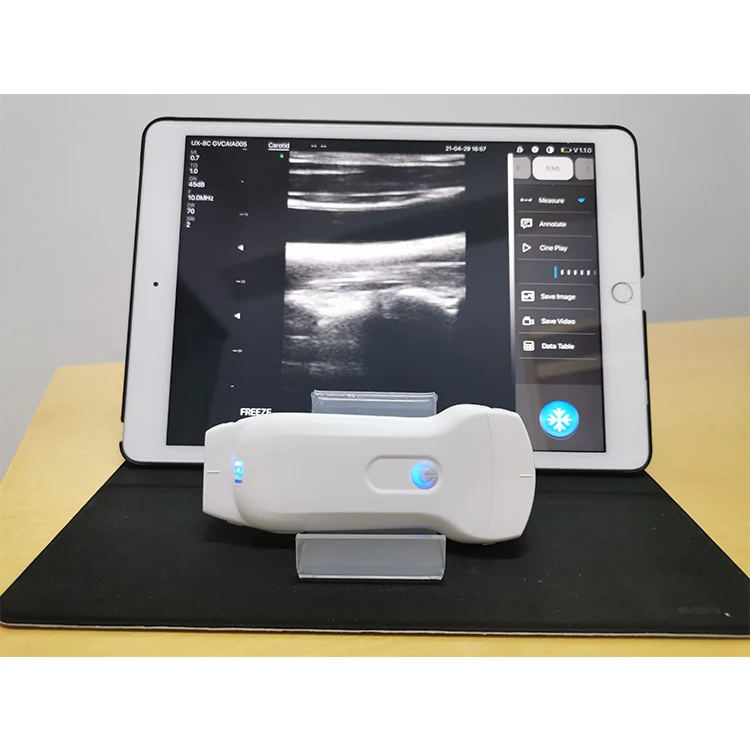 

Double Probes Wireless Color Doppler Ultrasound Scanner Wifi Ultrasound MSLPU80