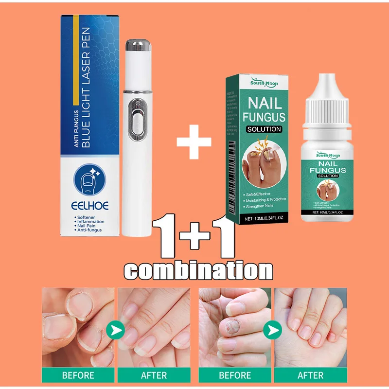 Nail Fungal Treatment Feet Care Essence Repair Nail Fungus Removal Serum Gel Anti Infection Paronychia Onychomycosis