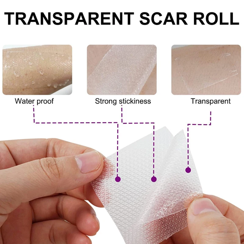 1Pcs Scar Patches Remove Silicone 1mm Gel Treatment Patch Burn Wounds Efficient Surgery Scar Tape Transparent Skin Repair