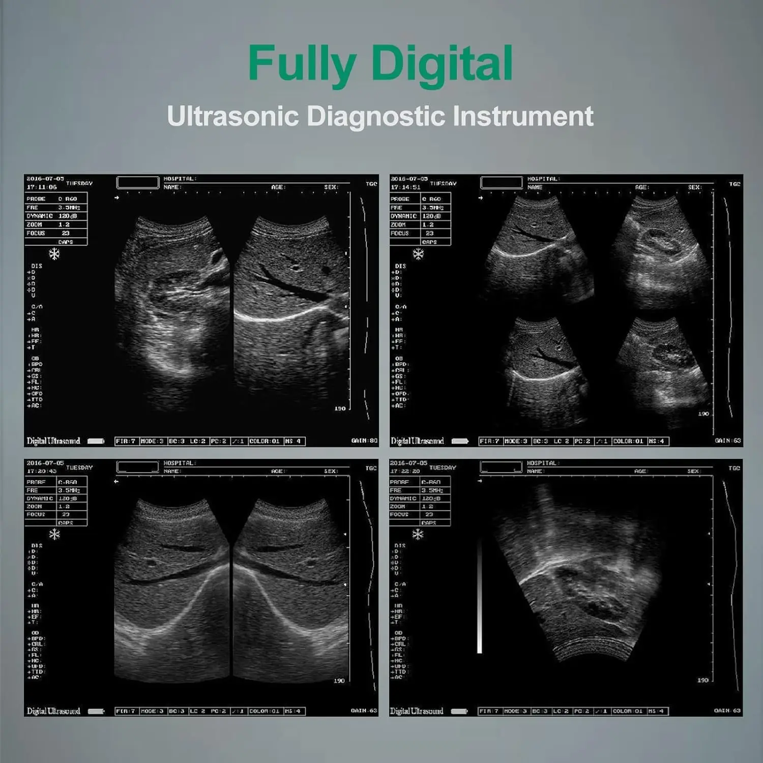 Ultrasound Scanner Veterinary for Pregnancy, Vet Portable B-Ultra Sound Scanner