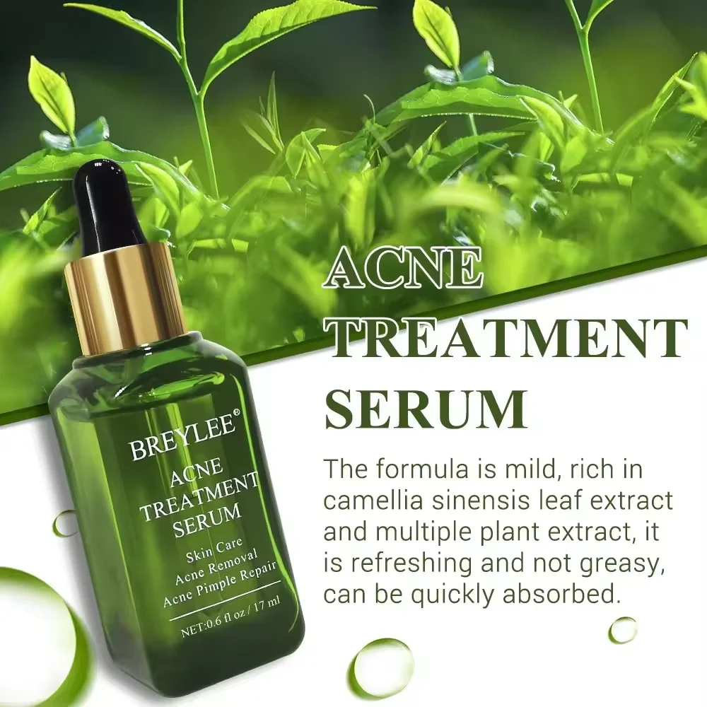 BREYLEE Acne Treatment Serum Facial Essence Liquid Shrink Pores   Acne Removal Repair Serum17ml 5