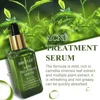 BREYLEE Acne Treatment Serum Facial Essence Liquid Shrink Pores   Acne Removal Repair Serum17ml 5