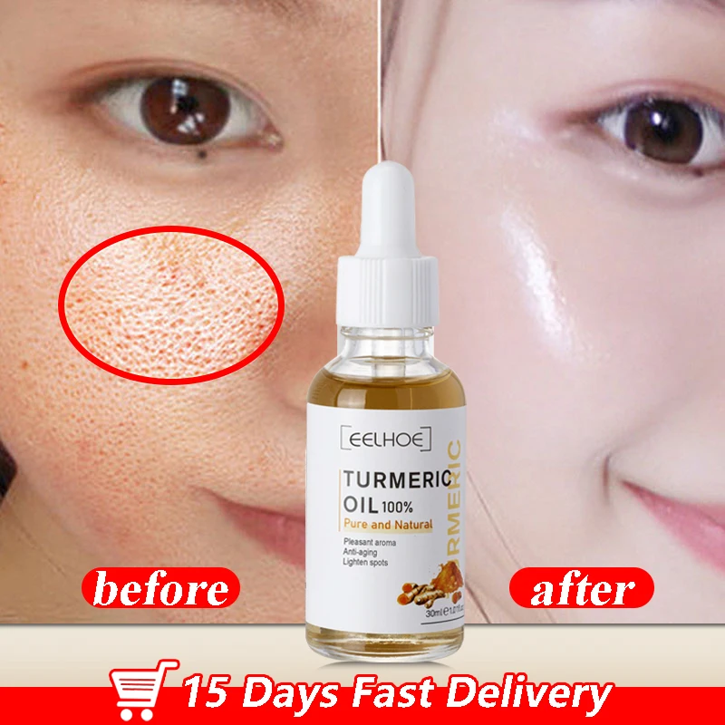 Turmeric Freckle Whitening Serum Curcumin Oil Brighten Fade Dark Spot