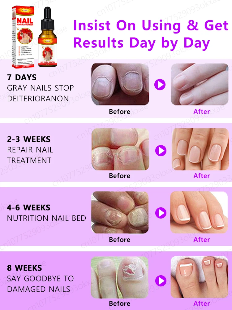 nail