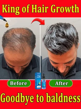 The most effective hair growth essential oil 1