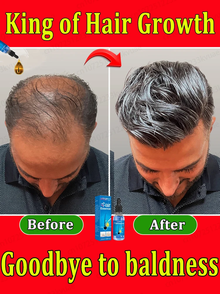 Effective Hair Growth Oil for All Hair Types