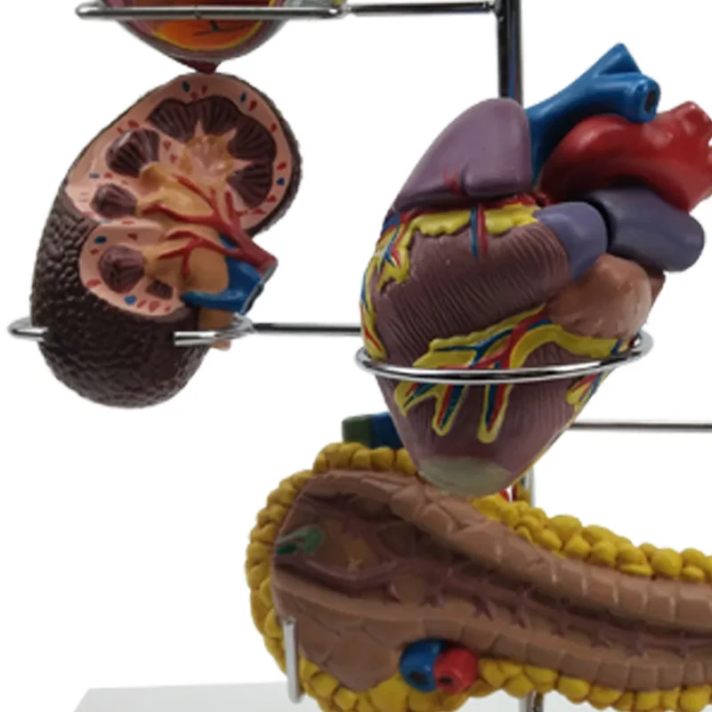 Модель человеческого органа для диабетиков, медицинские товары, Обучающие принадлежности