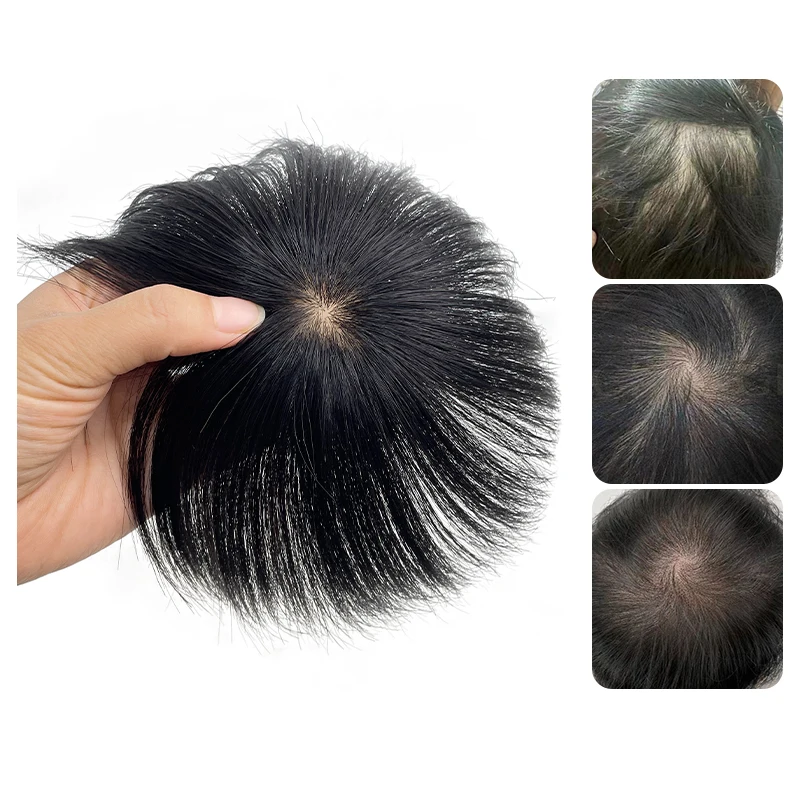 Mens Wig Human Hair Toupee Swiss Lace Pieces Wigs Natural Breathable Thinning Hair Cover-Up Forehead Balding Concealment