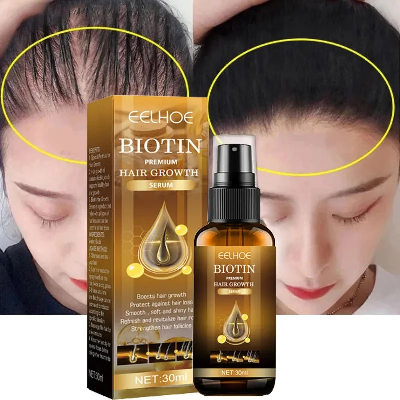 Biotin Fast Hair Growth Products Anti Hair Loss Serum Spray Prevent Baldness Treatment Scalp Beard Beauty Hair Care Men Women biotin fast hair growth products anti hair loss serum spray prevent baldness treatment scalp beard beauty hair care men women