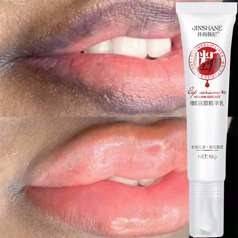 Lips Pink Fresh Lightening Bleaching Cream Treatment Remove Dark Smoke