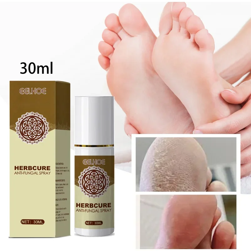 

Foot spray exfoliates prevents skin itching dry crack feet Anti Fungal Beriberi antiperspirant deodorizes Moisturizes care