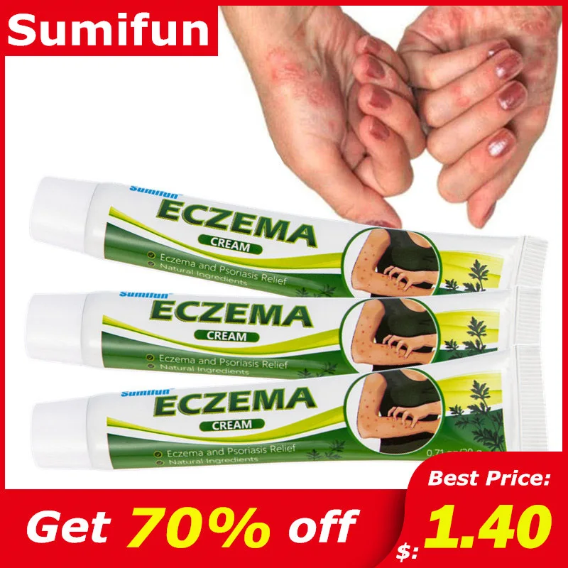 20g Sumifun Antibacterial Psoriasis Cream Dermatitis Eczematoid Eczema Ointment Cure Rash Urticaria Dermatologi Beauty | Красота и