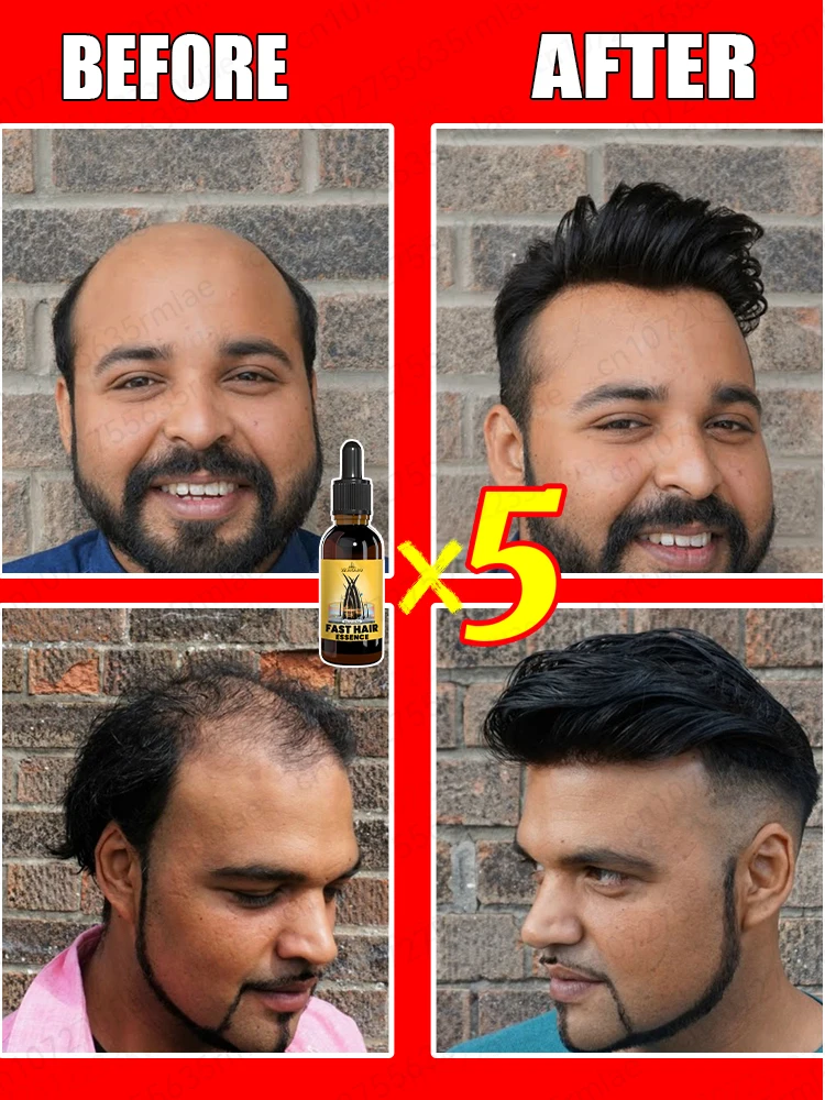 Hair Growth Serum Hair growth product solves hair loss and baldness problem makes hair grow longer