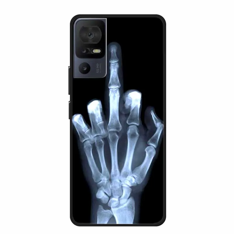 Animal-Themed Soft Silicone TPU Phone Case with Shockproof Protection