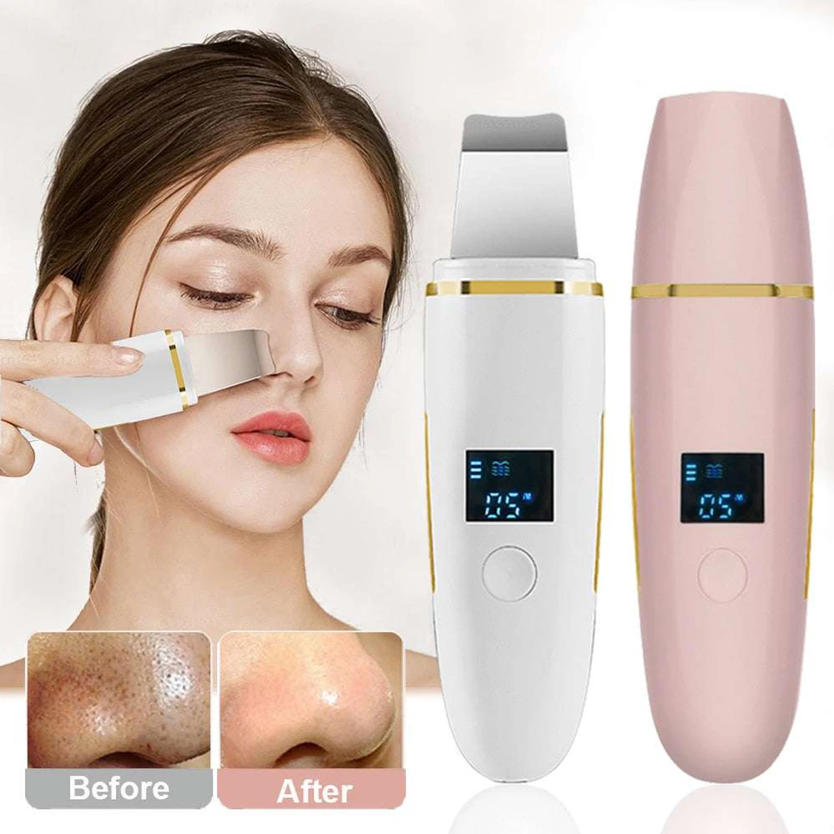 

Portable Facial Cleaner Skin Removal Scraper Skin Tightening Blackhead Remover Ultrasonic Ion Dead Skin Scrubber