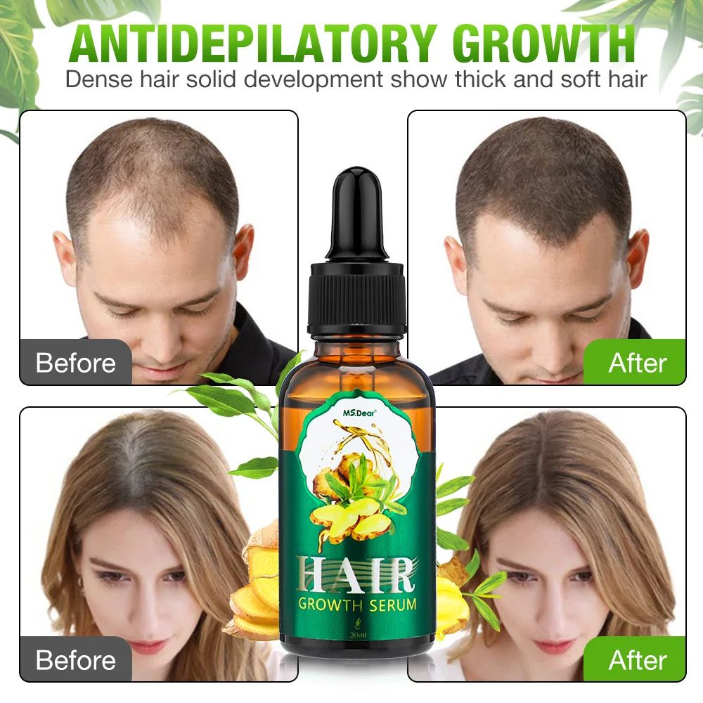 Hair Growth Products Ginger Fast Growing Hair Essential Oil Beauty Hair