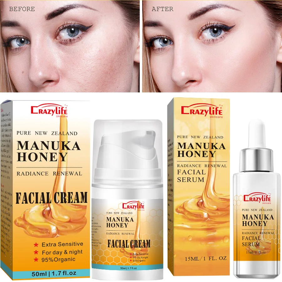 ManukaHoneySkinCare2pcsSetShrinkPoresMoisturizingWhitening