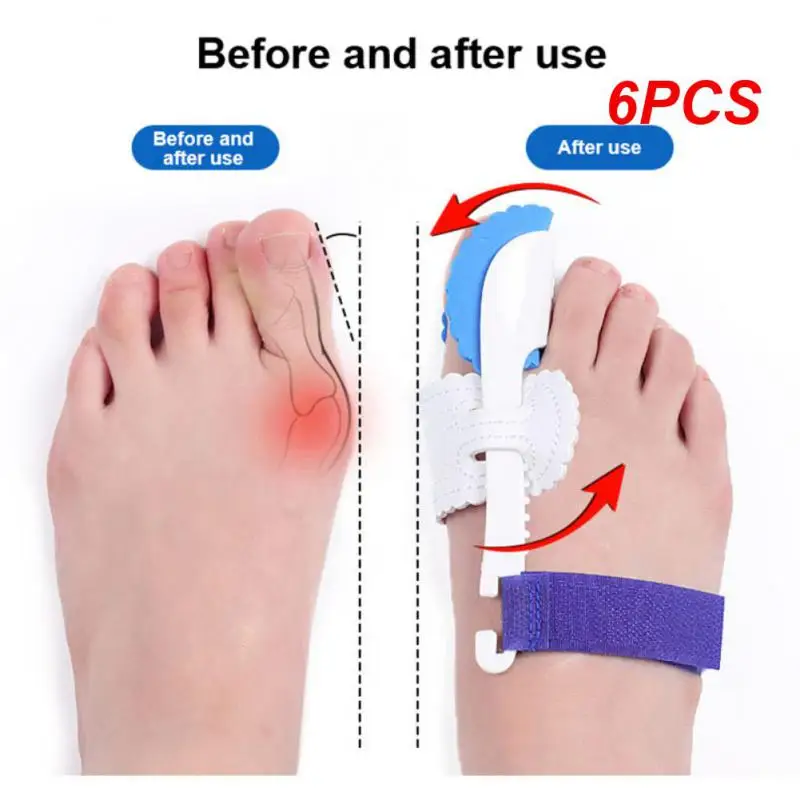 

6PCS Bone Toe Bunion Splint Straightener Corrector Pain Relief Hallux Valgus Correction Thumb Protector Foot Care Tools