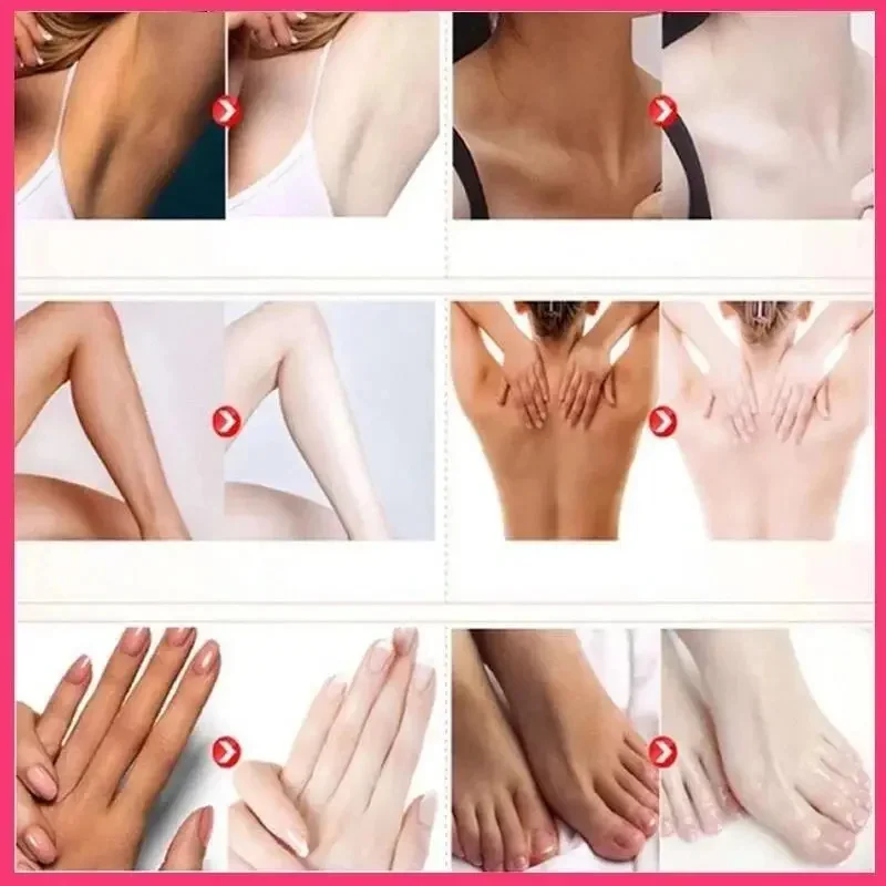 Body Whitening Cream Private Parts Underarm Legs Knee Bleach Lotion Inner Thigh Intimate Dark Remove Melanin Brighten Skin Care 3