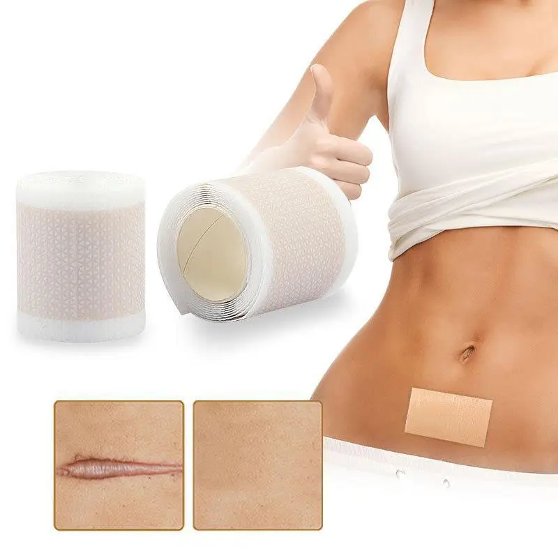 

1 Roll 100/150cm Silicone Gel Scar Sheet Patch Treatment Removal Tape Acne Trauma Burn Scar Cover Skin Repair Section Ear Beauty