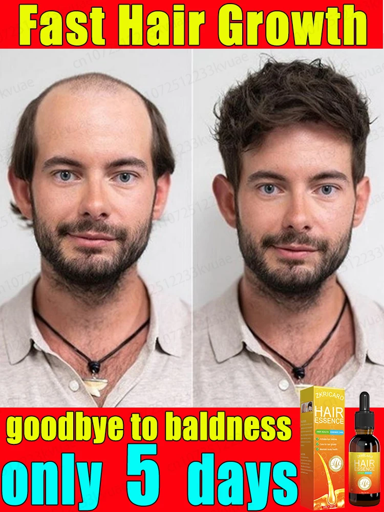 Itonlytakes7daystorepairbaldnessHairgrowthessentialoilcan