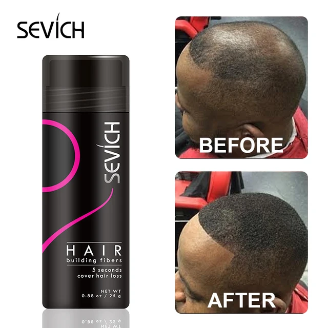 10 Color Africa Hair Building Fiber Powder Spray Keratin Instant Salon Regrowth Powder Anti-Hair Loss Hair Growth Product Sevich - Image 2