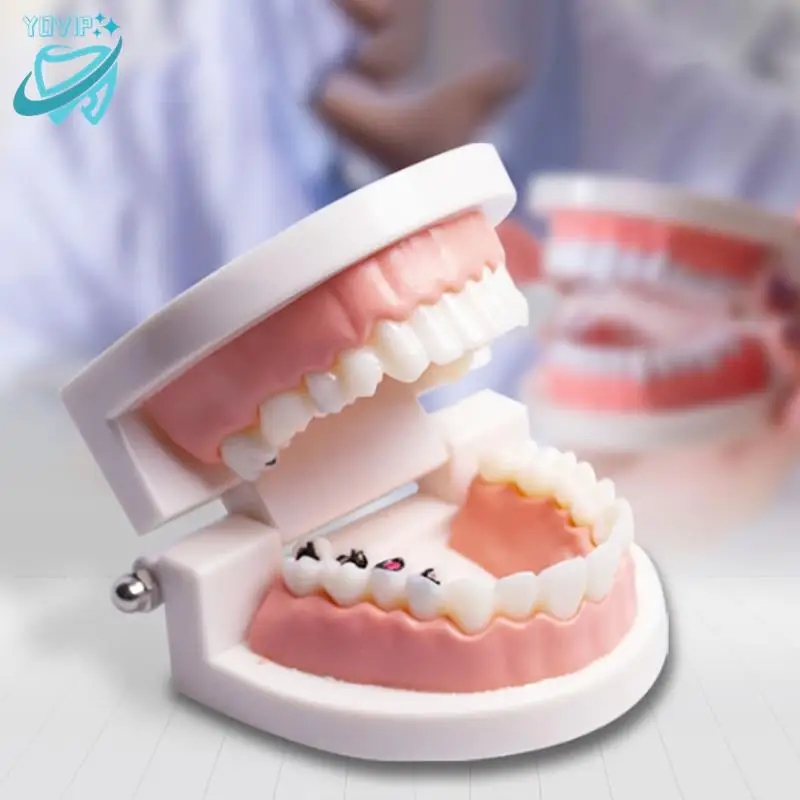 

1PCS Dental Teaching Teeth Model Children Kid Study Cavities Model Demonstration Tool Standard Dentist Student Decay Model