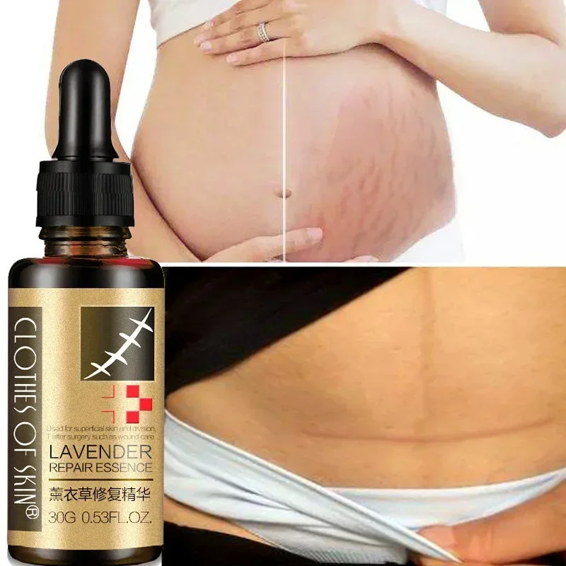 

Scar Removal Pregnancy Skincare Safe For Pregnant Women Healthy Skin Repairing Healing Properties Radiant Glow Reduce Fine Lines