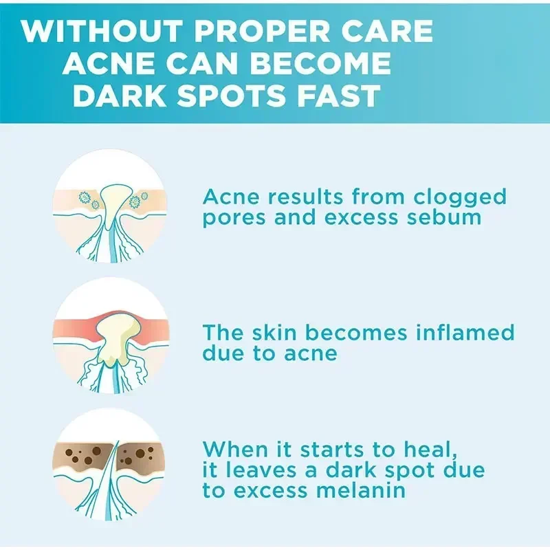 Skin Texture | Pore Refining Resurfacing, Brightening Facial Serum with Retinol and Niacinamide Non-Comedogenic 4