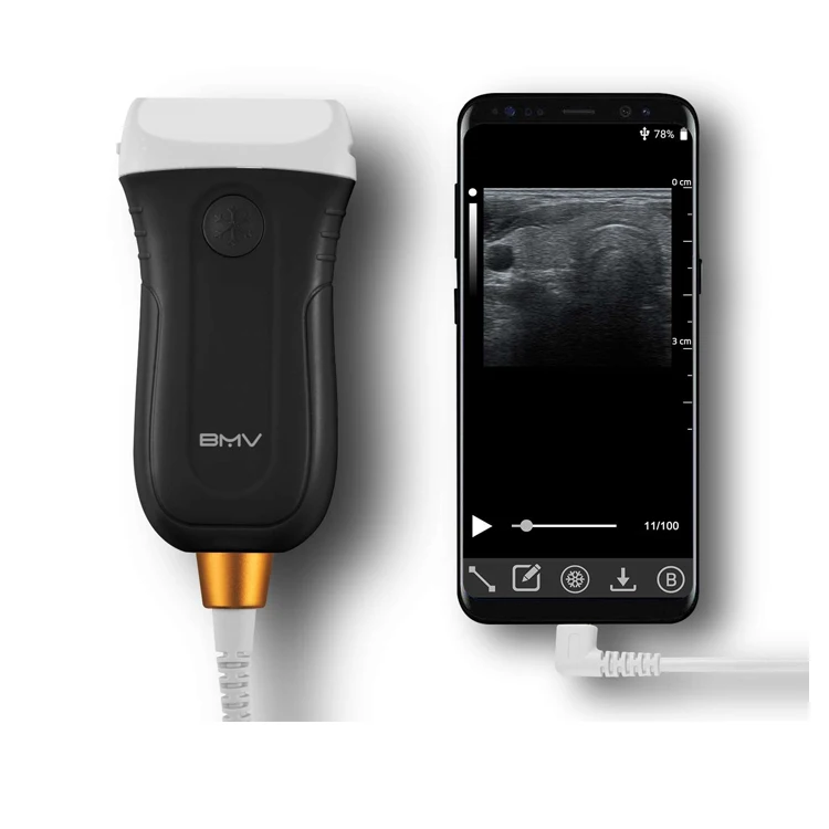 최고의 수의학 장비 USB 프로브 듀오 컨벡스 컬러 스캐너 초음파 스캐너 수의학 초음파 소나