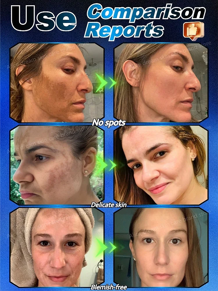 Effectively solves all pigmentation symptoms 2