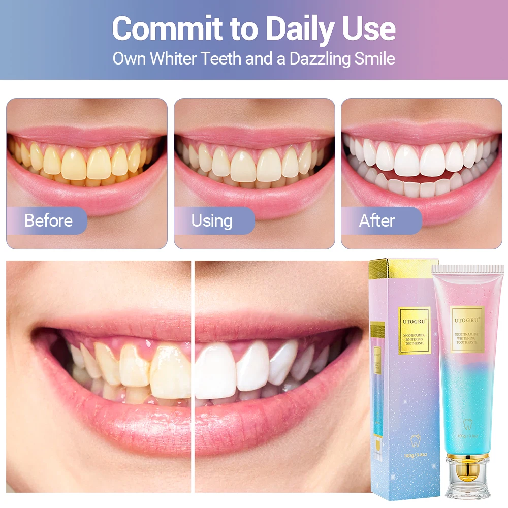 Niacinamide Whitening Toothpaste for Fresh Breath and Clean Teeth