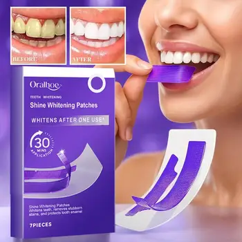 Strisce sbiancanti per denti, pulizia delicata dei denti, rimozione delle macchie, cura orale quotidiana contro l'ingiallimento, per un sorriso luminoso e duraturo, uso domestico