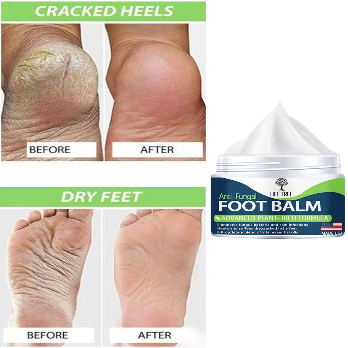 

Traditional Chinese Oil Anti-Drying Crack Foot Cream Heel Cracked Repair Cream Removal Dead Skin Hand Feet Care Foot Mask