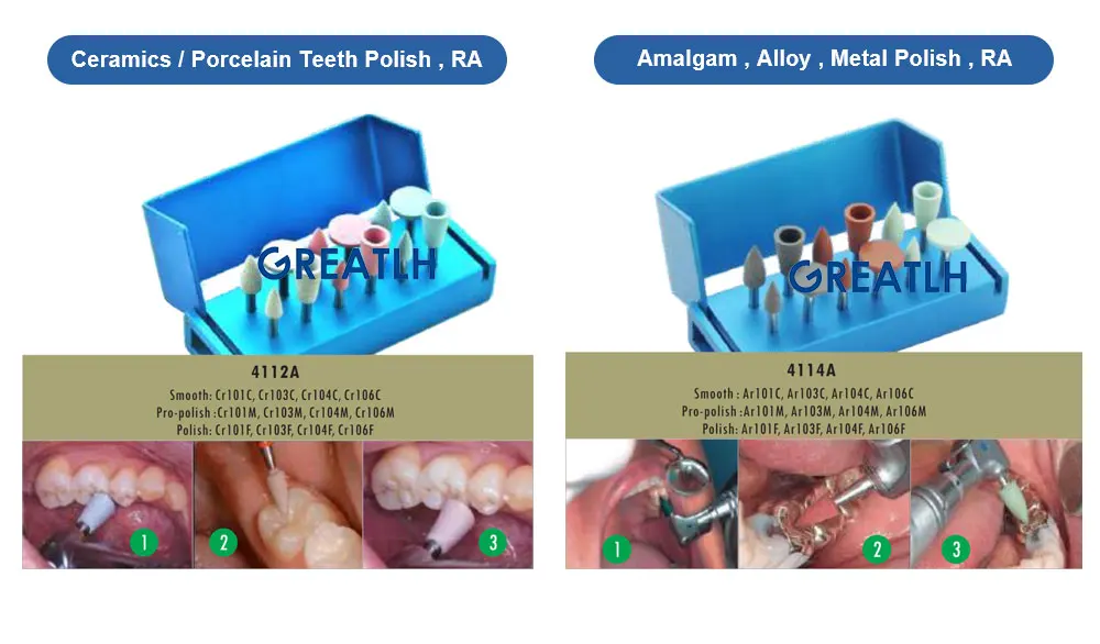 Resin Polishing Kits