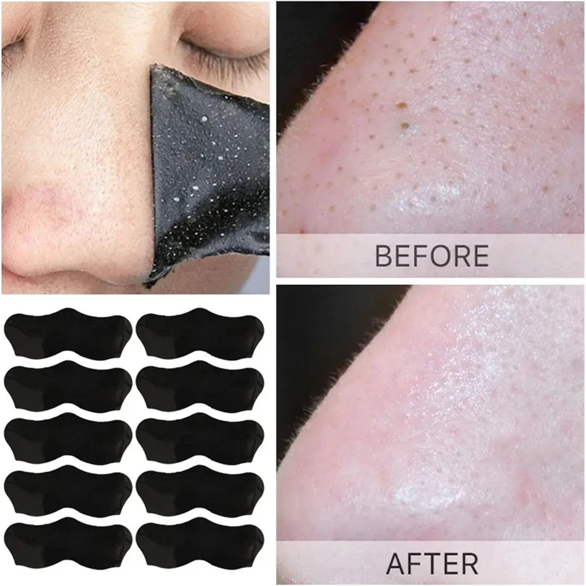 10/15/20/50Pcs Nose Blackhead Remover Mask Pore Cleaner Acne Treatment Mask Nose Pore Deep Clean Stickers Skin Care Patch