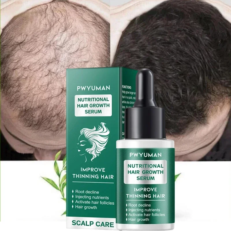 

Fast Hair Growth Serum Anti Hair Loss Essential Oil Prevent Baldness Scalp Treatment Nourish Repair Damaged Regrowth Hair Care