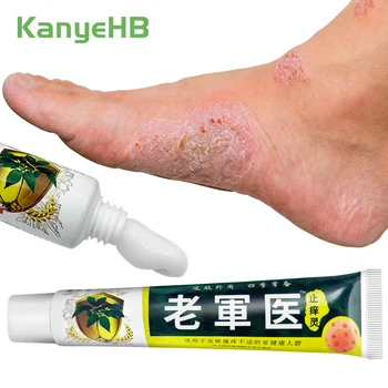 1Pcs Psoriasis Cream Dermatitis Eczema Anti-fungal Herbal Cream Skin Fungal Infection Treatment Cream Skin Itch Ointment S114