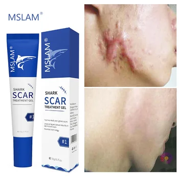 Scar Removal Cream Gel (1pc) 2023 Sadoun.com