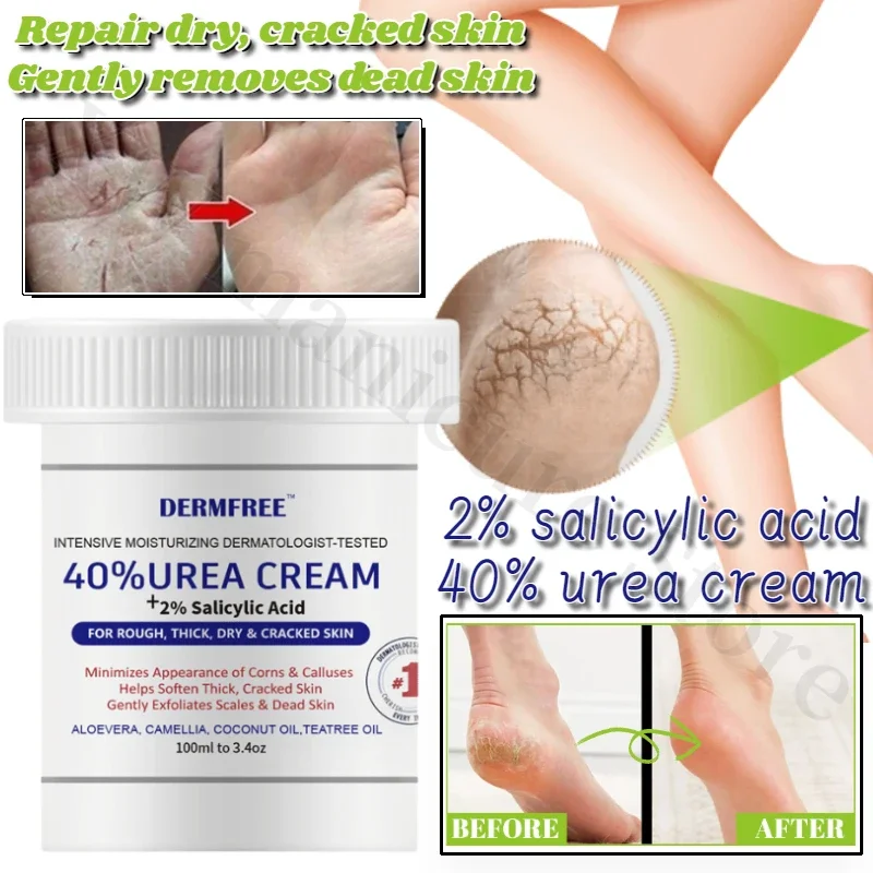 Urea Cream Anti-crack Frostbite Cream Cracked Heels Repair Cream Foot Exfoliation Dead Skin Cleaning Repair 100ML