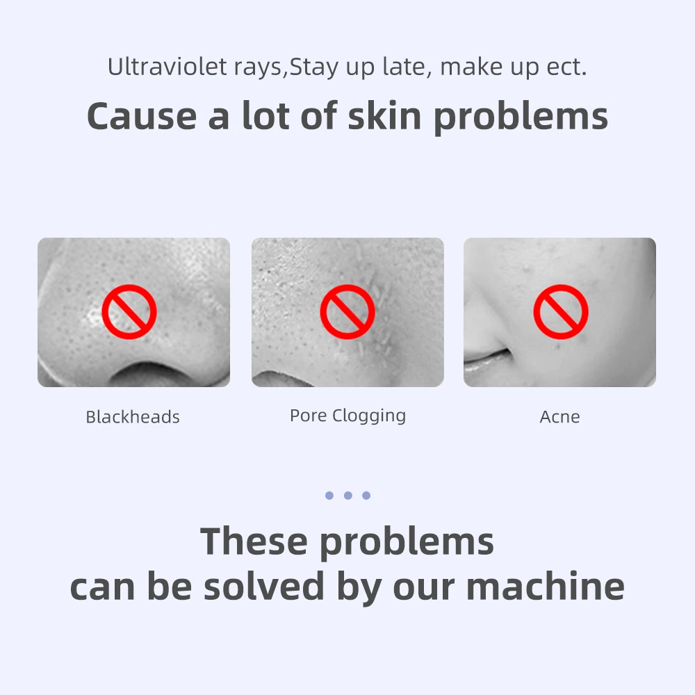 Ultrasonic Skin Scrubber Facial Cleaner