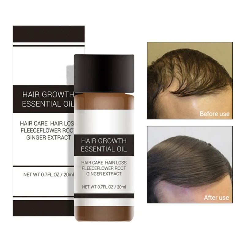 

Unisex Hair Growth Essence Oil Liquid Treatment Anti Hair Loss Nourishing Anti-drying Hair Care