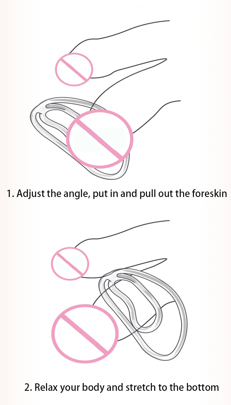 Vorhaut Abdeckung/Korrektur Sex Spielzeug Pseudo-Mädchen Umwandlung Clip Metall Hohl Keuschheit Käfig Bondage Männlich Übung Clips_voghion.com