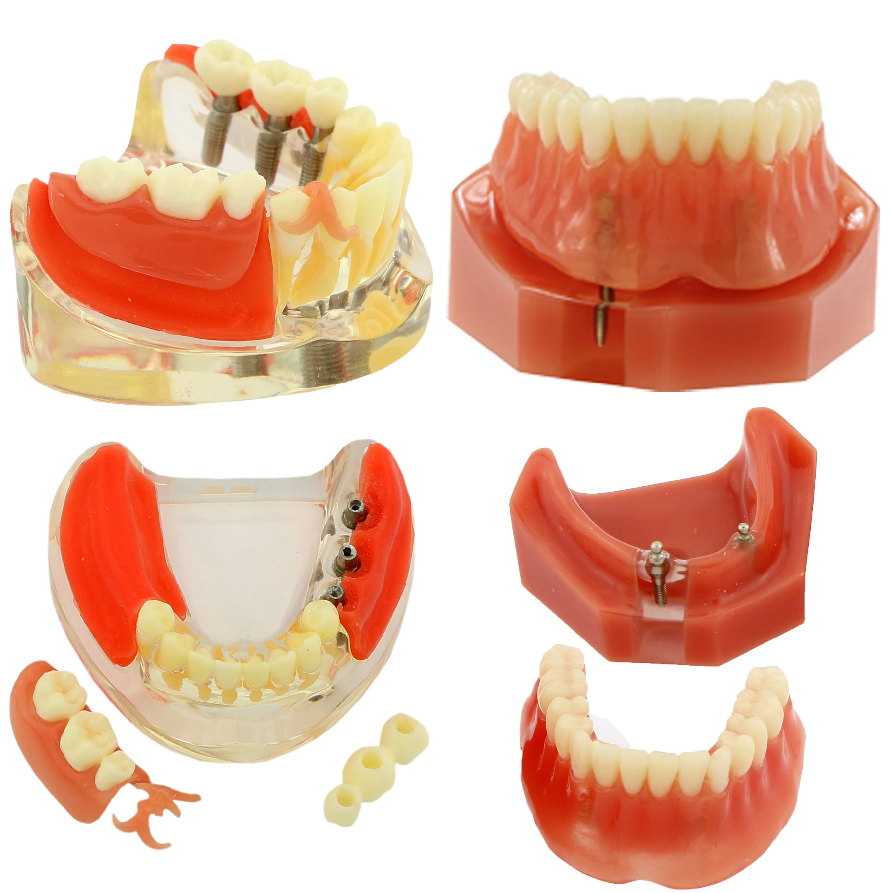 thumbnail image 2 of Dental Typodont Model With Removable Teeth 32 Teeth Model For Dental 2 of 13