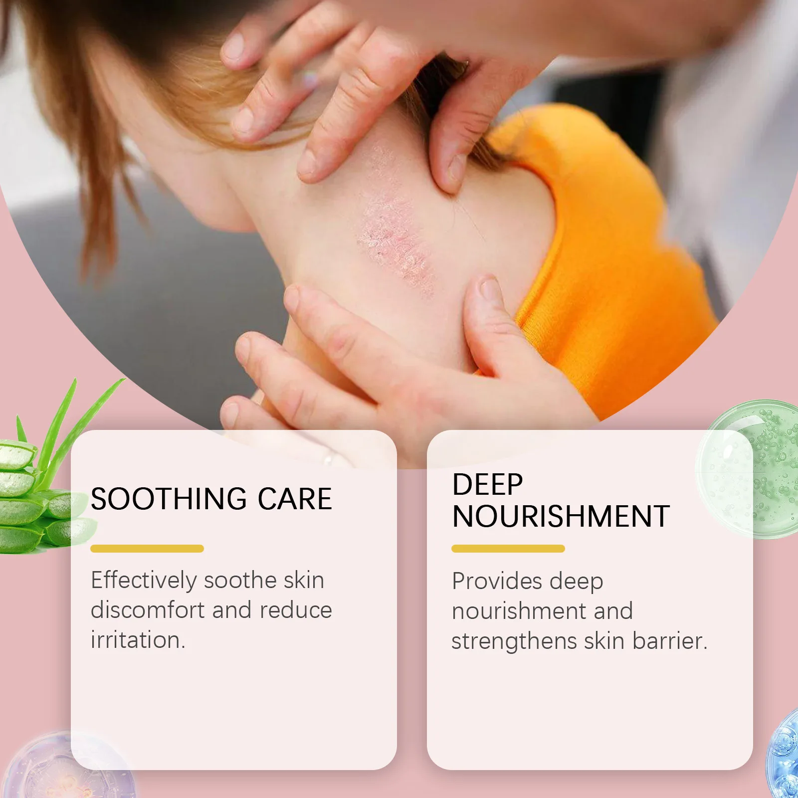 Herbal Psoriasis Ointment Eczematoid Skin Antipruritic Repair Cream Dermatitis Urticaria Rash Antibacterial Disinfect Skin Care