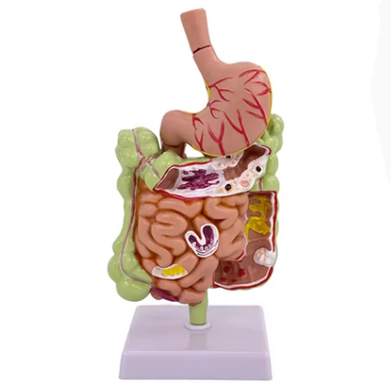 

Stomach Large Intestine Rectal Anatomy Model Human Digestive System Anatomical Medical Teaching Tools Drop Shipping