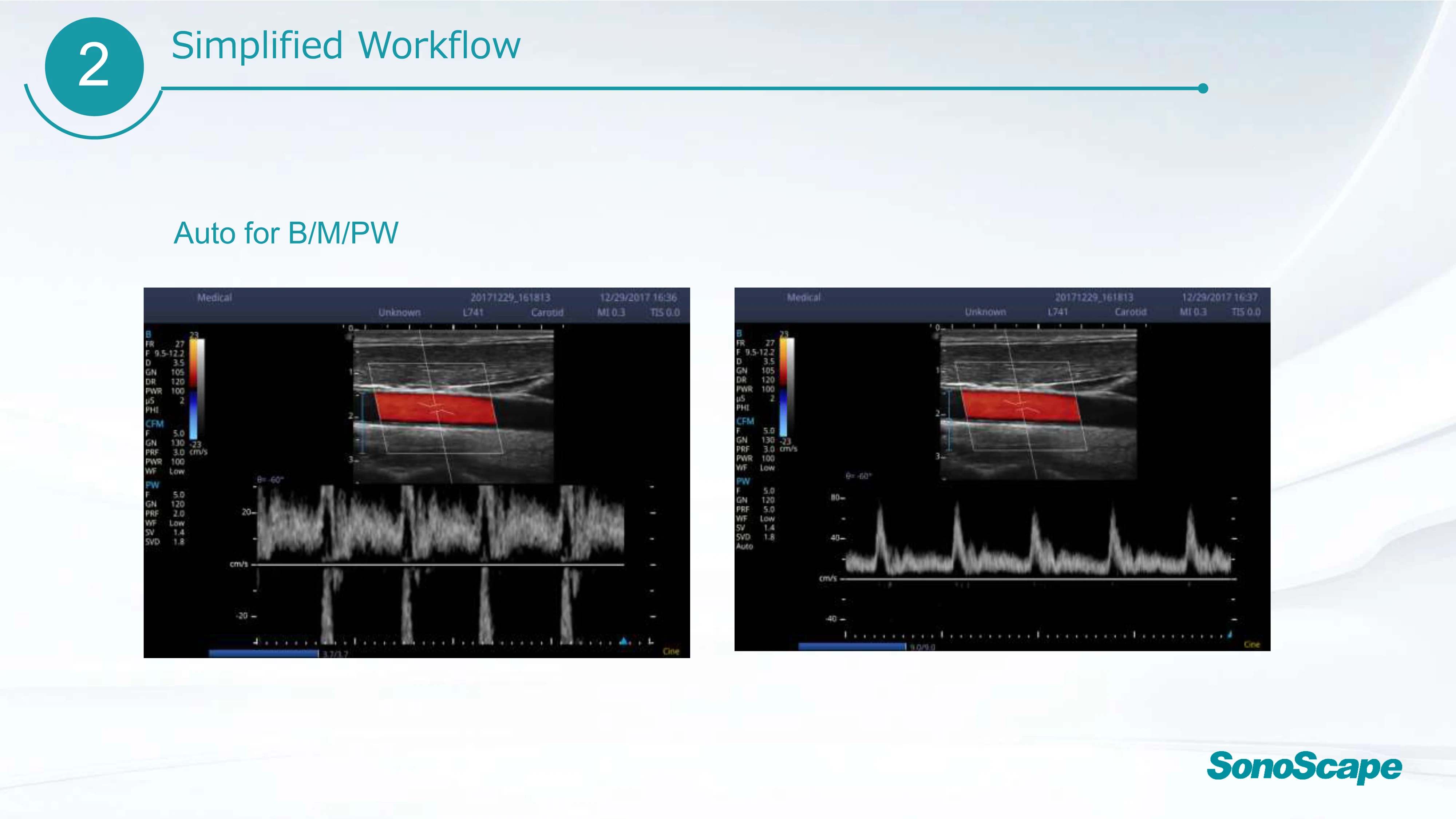 SonoScape E1 veterinary ultrasound medical ultrasound instruments vet black and white ultrasound scanner with rectal probe L741V 4