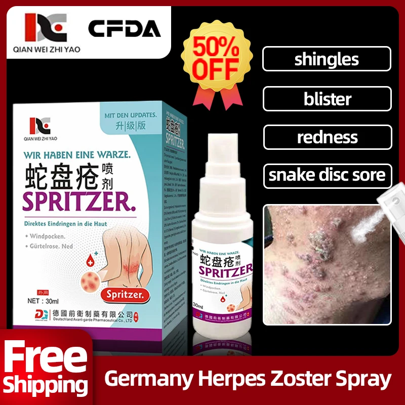 HerpesZosterTreatmentHerpesSimplexCureSprayShinglesGermany